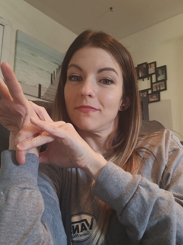 Hypermobile joints of the wrist